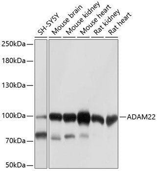 Western blot analysis of extracts of various cell lines, using ADAM22 antibody  at 1:1000 dilution.
Secondary antibody: HRP Goat Anti-Rabbit IgG   at 1:10000 dilution.
Lysates/proteins: 25ug per lane.
Blocking buffer: 3% nonfat dry milk in TBST.
Detection: ECL Basic Kit .
Exposure time: 1s.