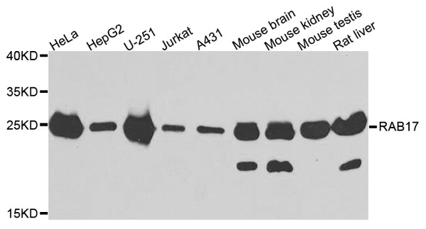 Western blot analysis of extracts of various cells, using RAB17 antibody.