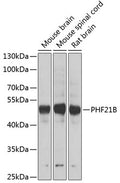 PHF21B polyclonal antibody – Figure 1 of 2