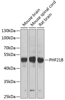 PHF21B polyclonal antibody – Figure 1 of 2