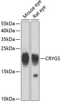 CRYGS polyclonal antibody – Figure 1 of 1