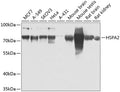 HSPA2 polyclonal antibody – Figure 1 of 3