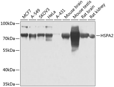 HSPA2 polyclonal antibody – Figure 1 of 3