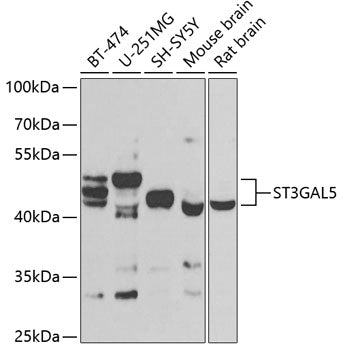 ST3GAL5 polyclonal antibody – Figure 1 of 1