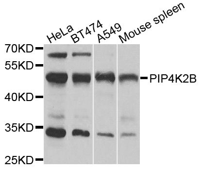 Western blot analysis of extracts of various cells, using PIP4K2B antibody.