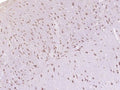 Paraformaldehyde-fixed, paraffin embedded (Mouse brain); Antigen retrieval by boiling in sodium citrate buffer (pH6.0) for 15min; Block endogenous peroxidase by 3% hydrogen peroxide for 20 minutes; Blocking buffer (normal goat serum) at 37°C for 30min; Antibody incubation with (Prickle 2) Polyclonal Antibody, Unconjugated at 1:400 overnight at 4°C.