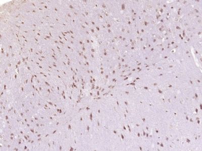 Paraformaldehyde-fixed, paraffin embedded (Mouse brain); Antigen retrieval by boiling in sodium citrate buffer (pH6.0) for 15min; Block endogenous peroxidase by 3% hydrogen peroxide for 20 minutes; Blocking buffer (normal goat serum) at 37°C for 30min; Antibody incubation with (Prickle 2) Polyclonal Antibody, Unconjugated at 1:400 overnight at 4°C.