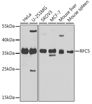 RFC5 polyclonal antibody – Figure 1 of 2