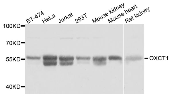 Western blot analysis of extracts of various cell lines, using OXCT1 antibody.