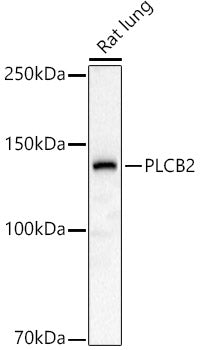 PLCB2 polyclonal antibody – Figure 1 of 2