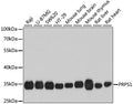 PRPS1 polyclonal antibody – Figure 1 of 1
