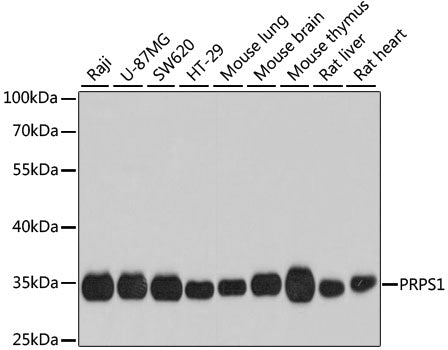 PRPS1 polyclonal antibody – Figure 1 of 1