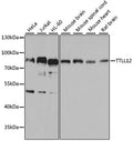 TTLL12 polyclonal antibody – Figure 1 of 3