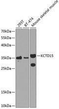 KCTD15 polyclonal antibody – Figure 1 of 3
