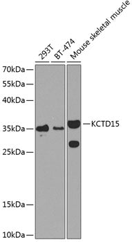KCTD15 polyclonal antibody – Figure 1 of 3