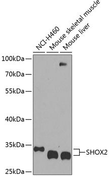 SHOX2 polyclonal antibody – Figure 1 of 1