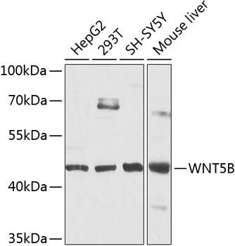 WNT5B polyclonal antibody – Figure 1 of 2