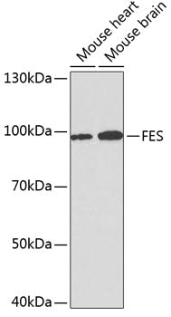 Western blot analysis of extracts of various cell lines, using FES antibody  at 1:1000 dilution.
Secondary antibody: HRP Goat Anti-Rabbit IgG   at 1:10000 dilution.
Lysates/proteins: 25ug per lane.
Blocking buffer: 3% nonfat dry milk in TBST.