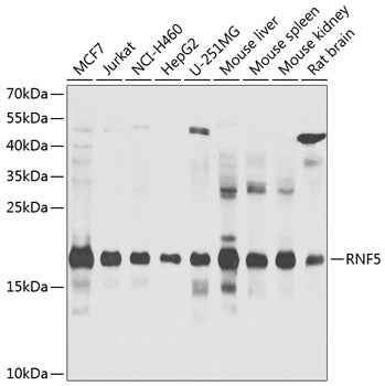 RNF5 polyclonal antibody – Figure 1 of 4