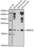 UBE2NL polyclonal antibody – Figure 1 of 1