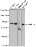 AVPR1A polyclonal antibody – Figure 1 of 3