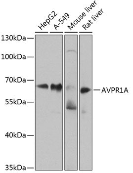 AVPR1A polyclonal antibody – Figure 1 of 3