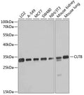 CLTB polyclonal antibody – Figure 1 of 1