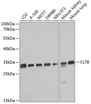 CLTB polyclonal antibody – Figure 1 of 1