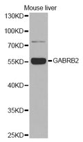 Western blot analysis of extracts of various cell lines, using GABA A Receptor beta 2 ) Rabbit pAb  at 1:1000 dilution.
Secondary antibody: HRP Goat Anti-Rabbit IgG   at 1:10000 dilution.
Lysates/proteins: 25ug per lane.
Blocking buffer: 3% nonfat dry milk in TBST.
Detection: ECL Basic Kit .
Exposure time: 180s.