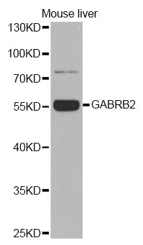 Western blot analysis of extracts of various cell lines, using GABA A Receptor beta 2 ) Rabbit pAb  at 1:1000 dilution.
Secondary antibody: HRP Goat Anti-Rabbit IgG   at 1:10000 dilution.
Lysates/proteins: 25ug per lane.
Blocking buffer: 3% nonfat dry milk in TBST.
Detection: ECL Basic Kit .
Exposure time: 180s.