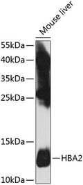 HBA2 polyclonal antibody – Figure 1 of 3