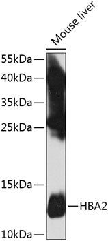 HBA2 polyclonal antibody – Figure 1 of 3