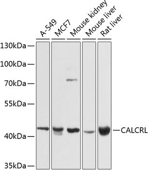 CALCRL polyclonal antibody – Figure 1 of 1