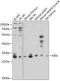 RPIA polyclonal antibody – Figure 1 of 3