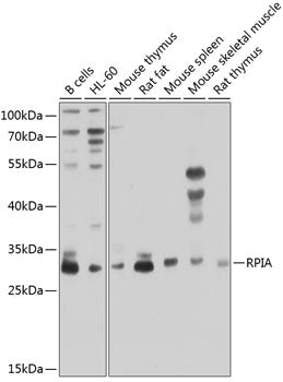 RPIA polyclonal antibody – Figure 1 of 3