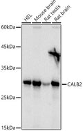 Calretinin polyclonal antibody – Figure 1 of 3