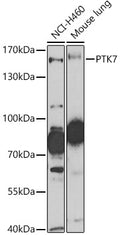 PTK7 polyclonal antibody – Figure 1 of 3