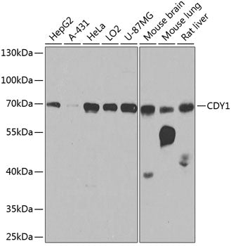 CDY1 polyclonal antibody - Figure 1 of 1