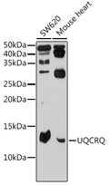 UQCRQ polyclonal antibody – Figure 1 of 1