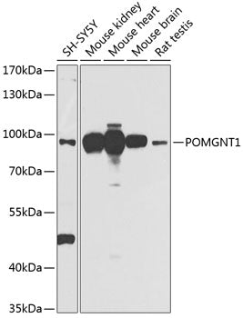 POMGNT1 polyclonal antibody – Figure 1 of 3