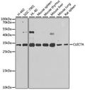 CLEC7A polyclonal antibody – Figure 1 of 1