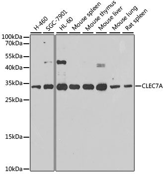 CLEC7A polyclonal antibody – Figure 1 of 1