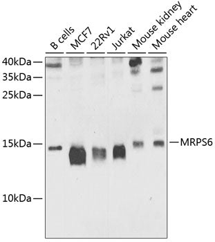 MRPS6 polyclonal antibody – Figure 1 of 1