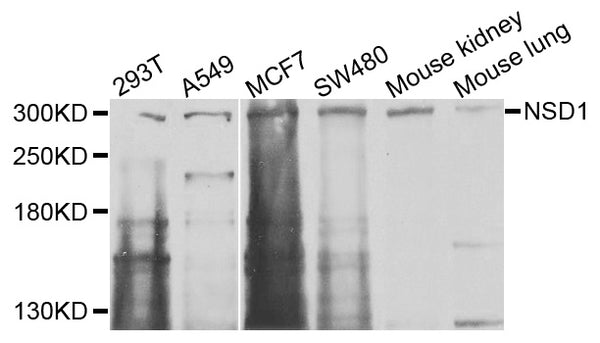 Western blot analysis of extracts of various cells, using NSD1 antibody.