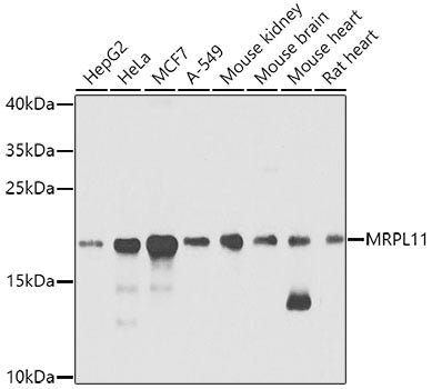 Western blot analysis of extracts of various cell lines, using MRPL11 antibody  at 1:1000 dilution.
Secondary antibody: HRP…