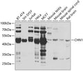 Western blot analysis of extracts of various cell lines, using CHN1 antibody  at 1:1000 dilution.
Secondary antibody: HRP Goat Anti-Rabbit IgG   at 1:10000 dilution.
Lysates/proteins: 25ug per lane.
Blocking buffer: 3% nonfat dry milk in TBST.
Detection: ECL Basic Kit .
Exposure time: 5s.