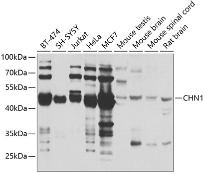 Western blot analysis of extracts of various cell lines, using CHN1 antibody  at 1:1000 dilution.
Secondary antibody: HRP Goat Anti-Rabbit IgG   at 1:10000 dilution.
Lysates/proteins: 25ug per lane.
Blocking buffer: 3% nonfat dry milk in TBST.
Detection: ECL Basic Kit .
Exposure time: 5s.