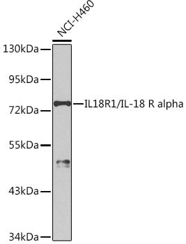 Western blot analysis of extracts of NCI-H460 cells, using IL18R1/IL-18 R alpha antibody  at 1:1000 dilution.
Secondary antibody: HRP Goat Anti-Rabbit IgG   at 1:10000 dilution.
Lysates/proteins: 25ug per lane.
Blocking buffer: 3% nonfat dry milk in TBST.
Detection: ECL Basic Kit .
Exposure time: 90s.