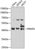 [KO Validated] PRMT6 polyclonal antibody – Figure 1 of 2