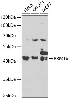 [KO Validated] PRMT6 polyclonal antibody – Figure 1 of 2